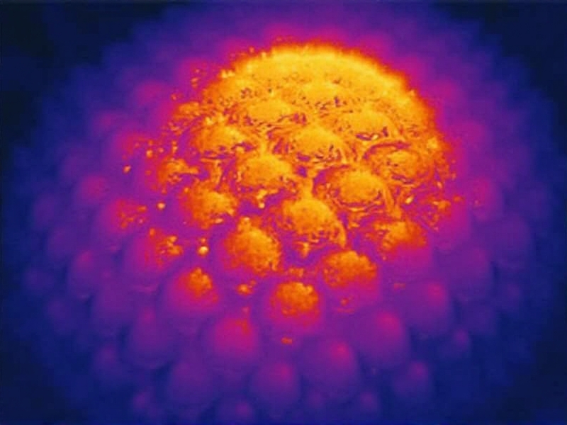 Thermal Imaging for Brood Health